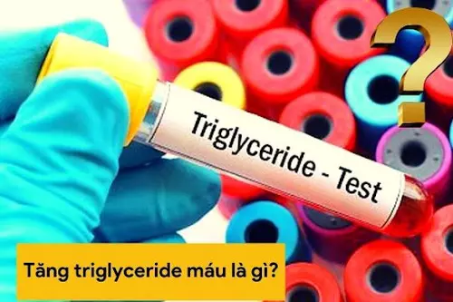 Các phương pháp điều trị tăng triglyceride máu hiệu quả